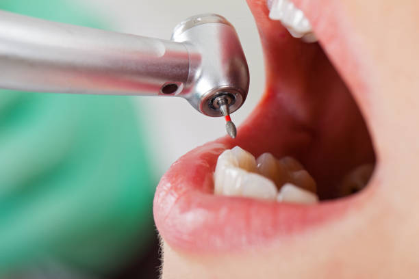 Best Emergency Dental Services for Seniors in New Lenox, IL